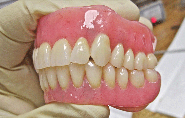 一般的な保険の入れ歯